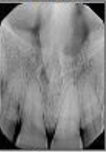 x-ray image of teeth