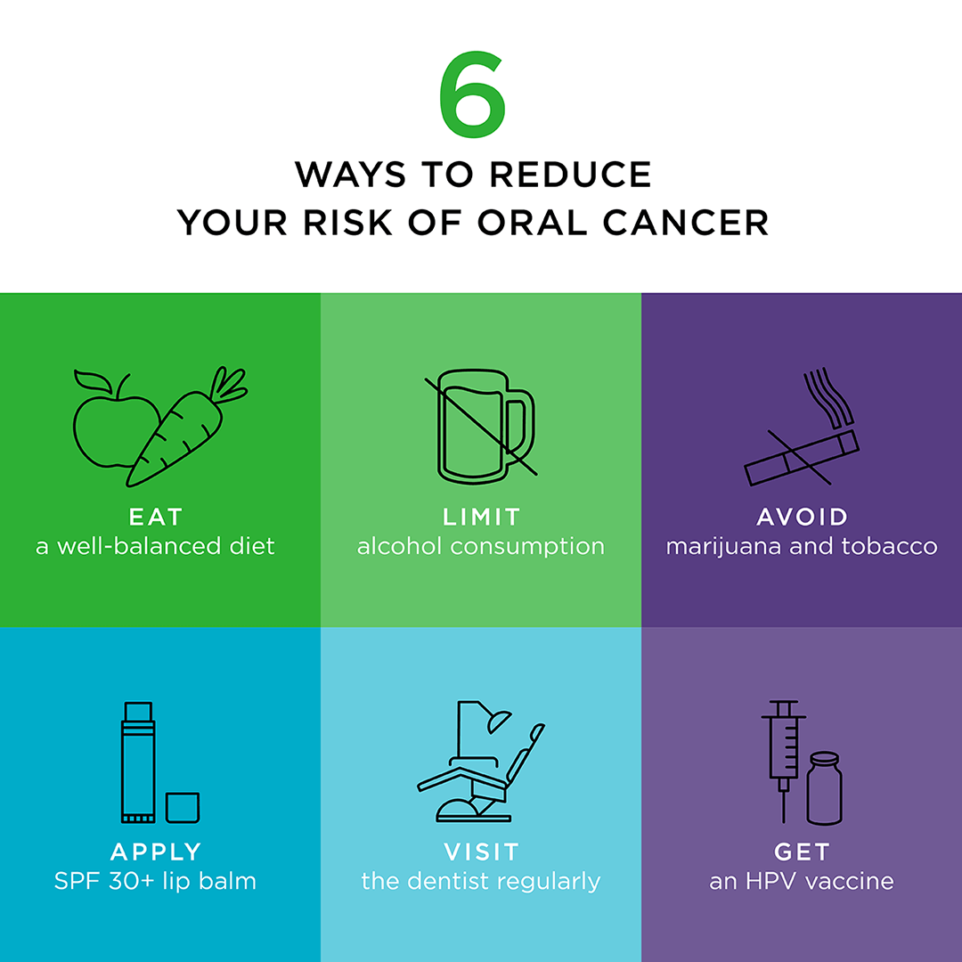 Six ways to reduce risk of oral cancer infographic